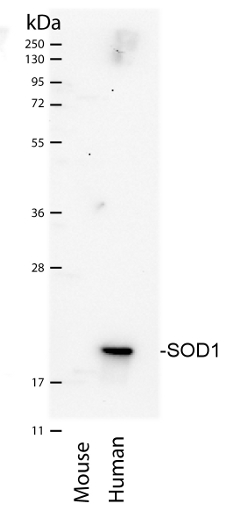 western blot using anti-SOD1 antibodies